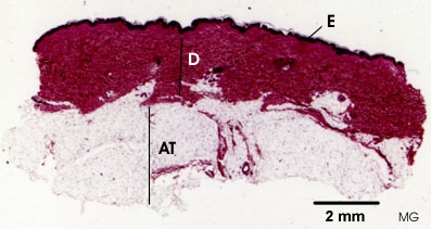 elastic-tissue-human-skin.jpg