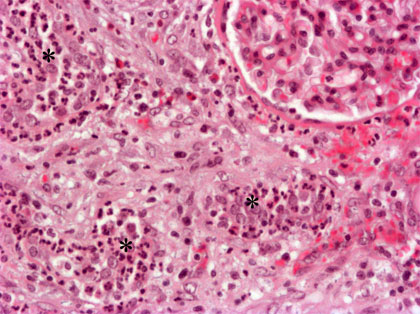 eosinophil granulocyte
