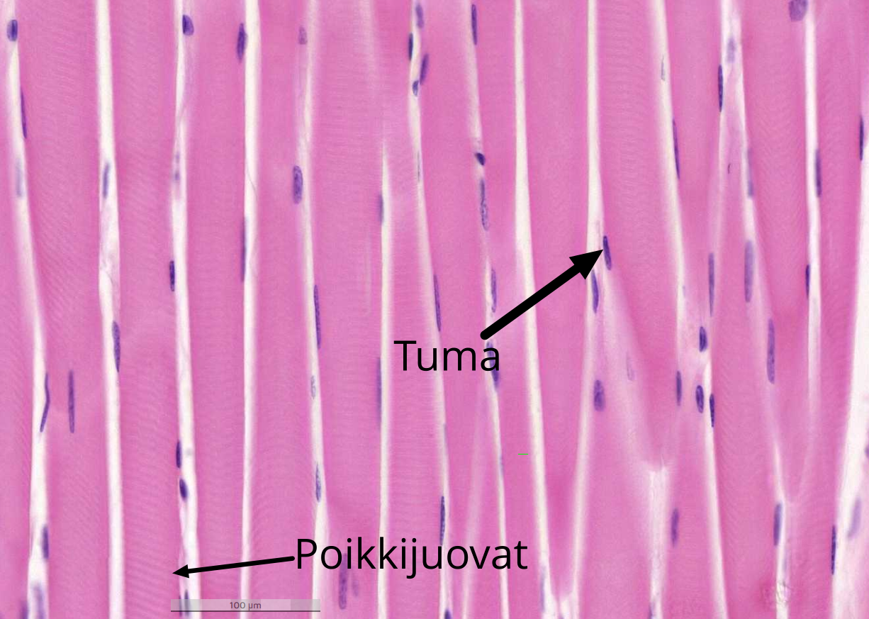 Solunetti Poikkijuovainen Lihas Solunetti Poikkijuovainen Lihas